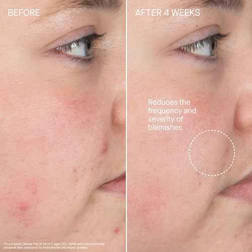 Augustinus Bader The Foaming Cleanser ? Luxury Gentle Hydrating Face Cleanser ? Removes Impurities & Excess Oil While Supporting Skin Barrier ? Soothing & Non-Drying Formula ? 150 ml / 5 fl oz