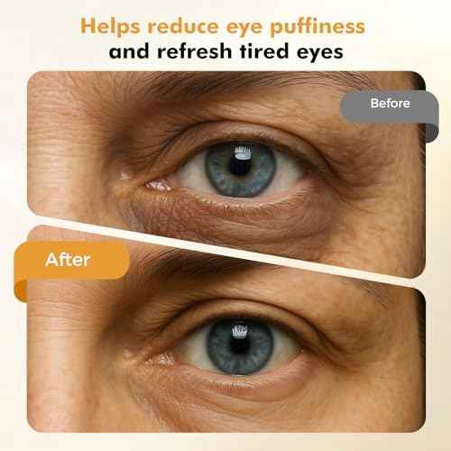 REDLOOK Depuffing Wand - Multi-Mode Cold & Heat Eye with Massager,At Home Face Roller Tool, Beauty Wand for Puffiness Reduction, Dark Circles, and Let The Skin Be Full of Radiance - Silver