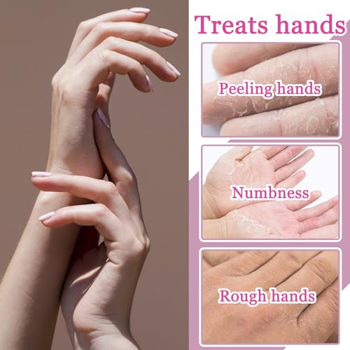 Hydrating Hand Masks, 6PCS Hand Mask Moisturizing Gloves for Men Women, Smooth Long Lasting Soft Exfoliating Hand Peeling Spa Mask Moisturizer Beauty Gift Set for Dry Cracked Rough Dull Hands£¨A)