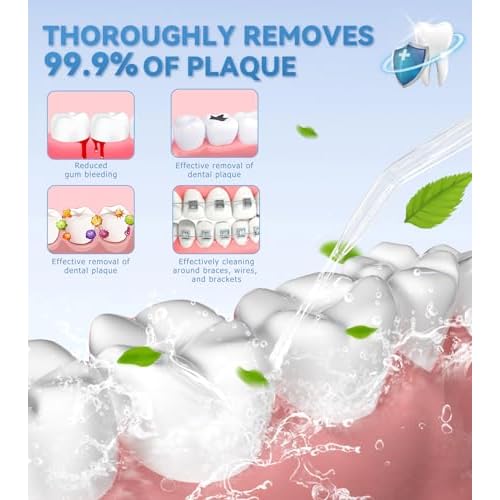Water Dental Flosser for Teeth Cleaning with 1000ML Large Capacity and UV Storage, 10 Adjustable Pressure Electric Oral Irrigator with 7 Jet Tips for Home Use, Gums, Braces (Ivory White)