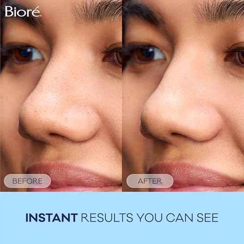 Bior? Original Blackhead Remover Strips, Deep Cleansing Nose Strips With Instant Pore Unclogging, Features C-Bond Technology, Oil-Free, Non-Comedogenic Use, 14 Count