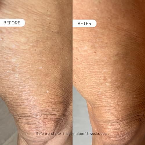 OneSkin BODY OS-01 Peptide Topical Supplement & Skin Longevity Age Reversal Moisturizer | Safe for Sensitive Skin, Fragrance-Free