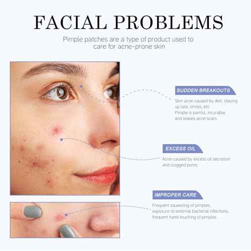 invisible pimple patches for face - acne patches, zit patches, Spot Stickers with Tea Tree and Salicylic Acid£¬4 Sizes (8mm, 10mm, 12mm & 14mm)£¬220 Count