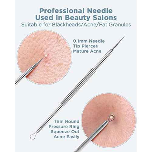 BESTOPE Blackhead Remover Blackhead Removal Pimple Comedone Extractor Tool - Treatment for Blemish Whitehead Popping Zit Removing with Metal Case (Silver)