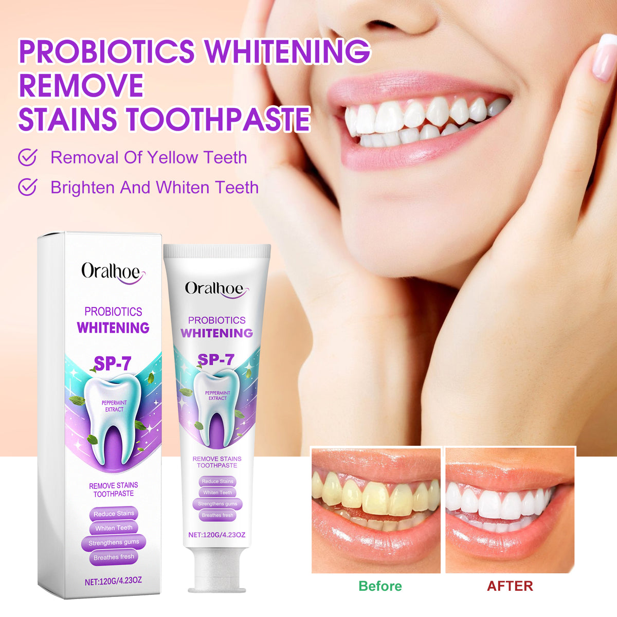 Probiotic Whitening Toothpaste 120g - Dental Care for Stain Removal & Fresh Breath