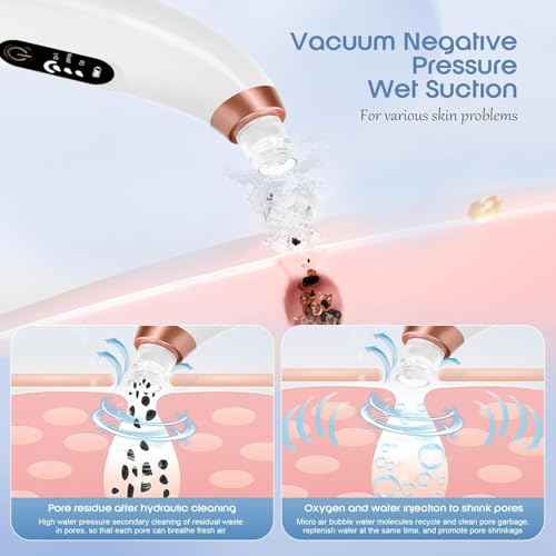 Blackhead Remover Vacuum - Water Cycle Facial Pore Cleaner with 3 Adjustable Suction Power 6 Probes USB Rechargeable - Blackhead Extractor Tool Kit for Women & Men