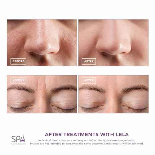 Spa Sciences - LELA - 4-in-1 Facial Spatula for Deep Cleansing, Pore Extraction, Serum Infusion, Anti-Aging and Contouring