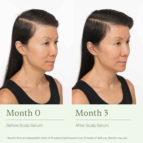 Divi Scalp Serum for Thinning Hair Clinically Tested, Non-Greasy Formula with Amino Acids, Caffeine & Rosemary Oil Promotes Healthy Scalp & Fuller-Looking Hair, Reduces Oil & Product Buildup