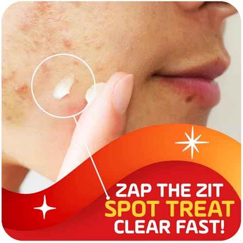 Asepxia 2% Salicylic Acid Acne Spot Treatment Cream | Drying Formula Targets Acne, Clears & Prevents Blemishes, Reduces Redness, Penetrates Pores, Pimple Cream, 1 Oz, 3-Pack