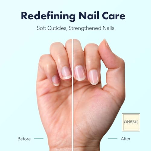 Onsen Secret Nail & Cuticle Repair Oil (10ml) - Dry Oil Formula - Japanese Tsubaki, Tea Tree & Jojoba - Strengthens Nails, Repairs Cuticles, Hydrates Skin & Hair - Natural & Vegan