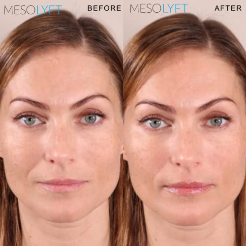 Lip Plumper with Roller to Instantly Plump Lips, Promotes Hydration and Fullness, Plumping Lip Gloss for Fuller Lips, Serum to Moisturize Your Lips (12 ML)