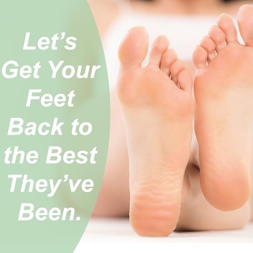 Dr. Entre's Callus Remover Gel: Extra Strength Callus Remover for Feet, Foot Callus Remover, Foot Care, Pedicure Tools Supplies, Dead Skin Remover, 4 oz
