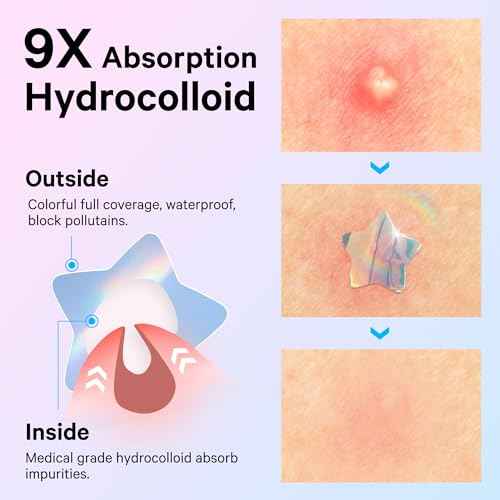 Sosky Hologram Pimple Patches for Face, Hydrocolloid Acne Patches with Salicylic Acid, Cute Star Zit Stickers,Colorful Blemish Covers,48 Count Blue Pink Star Heart Moon Butterfly