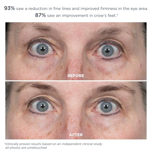 m-61 ProSmooth Retinol Eye Serum | 0.1% Non-Irritating Retinol Eye Serum with Vitamin C, 0.5 Fl Oz