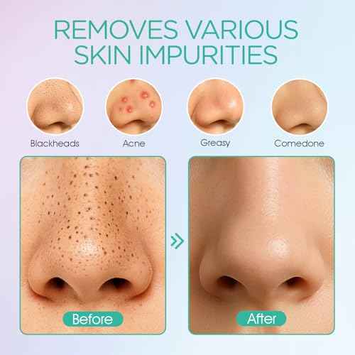 VOYOR Blackhead Remover Pore Vacuum - Electric Face Vacuum Pore Cleaner Acne White Heads Removal with 6 Suction Heads (BR410)