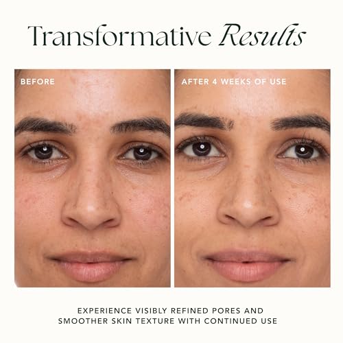 RANAVAT Refining Lotus Gel Cream - Hydrating Gel Moisturizer & Pore Minimizer ? Improves Radiance & Texture with Hyaluronic Acid & Floral Ketoacids (1.7 oz)
