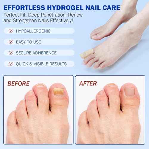 Fungal Nail Patches, Nail patches for toenails, Overnight Toe Nails Treatments for Damaged Foot Nails Repair and Care, Safe for Sensitive Skin, Easy to Apply (2)