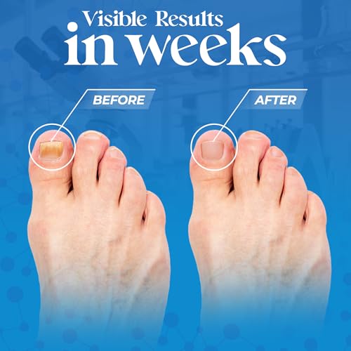 Aromasong Tea Tree Foot Soak with Magnesium Flakes and Dead Sea Foot Soaking Salts - Pedicure Tea Tree oil foot Soak for Dry Cracked Feet-Athlete's Callus Remover- Eliminates Odor- Packaging may vary