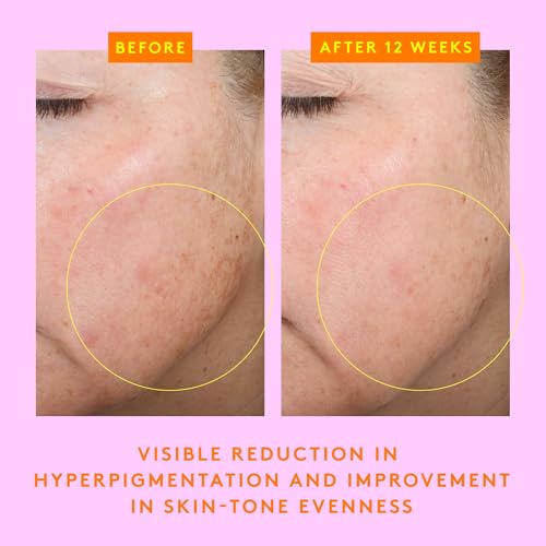 Drunk Elephant C-Firma Fresh Day Serum - 28 ml/.94 fl oz - 15% Illuminating Vitamin C - Clean Clinical Skincare - Cruelty-Free - Dermatologist-Tested - Free of Essential Oils, Silicones, and Fragrance