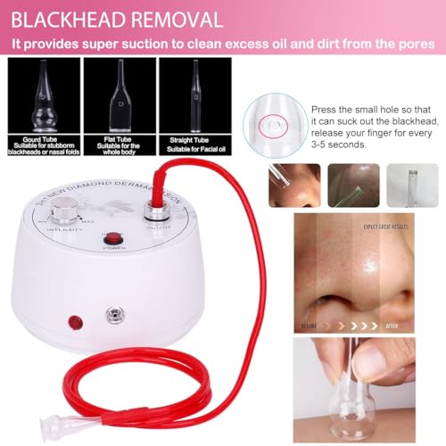 ¡¼3 IN 1 ¡½Microdermabrasion Machine, Beauty Star Professional Diamond Dermabrasion Facial Devices at Home