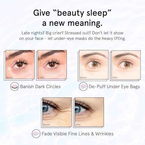 grace & stella Retinol Under Eye Patches for Puffy Eyes and Dark Circles - Restoring Gel Under Eye Masks with Hyaluronic Acid - Vegan Cruelty-Free Skincare, Birthday Gifts for Women (Purple, 24 Pairs)