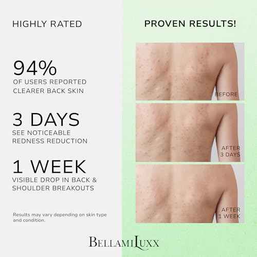 Back & Body Acne Spray Treatment: 2% Salicylic Acid & Tea Tree Oil Bacne Spray for Clear, Soothe & Moisturize - Effective for Men, Women, Teens with Back, Chest, Shoulder, Arm Acne