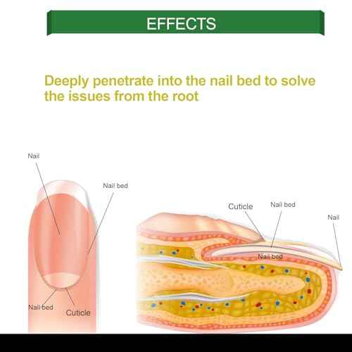 Ginger Nail Treatment Serum Oil, Nail Regrowth Serum, Nutrient Oil for Nail Cuticle Repairing, Promoting Regrowth, Strengthening, Plant-Based Formula with File Tool