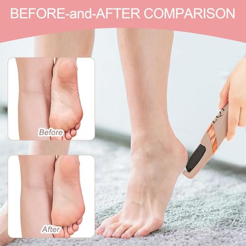 LQT¢ç Electric Foot File ? Rechargeable Callus Remover for Hard, Cracked Skin ? at-Home Pedicure Kit for Smooth Feet (Men & Women) (Pink)
