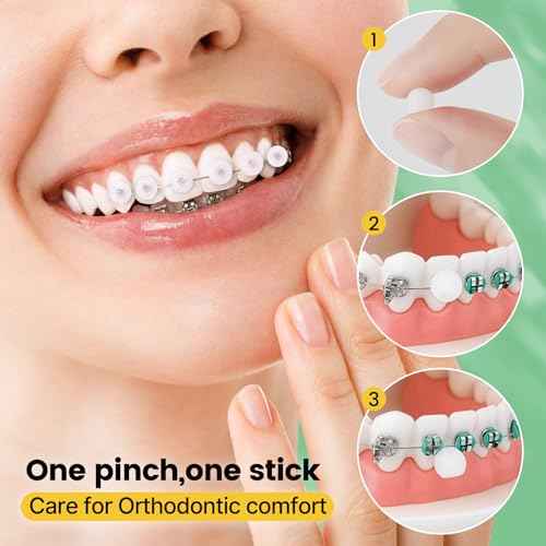 Orthodontic Wax for Braces Wax 120 Individual Hygienic Packaging Dental Wax Dots Mint