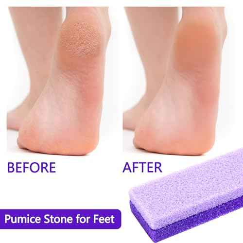 Pumice Stone for Feet 3 Pack ? Double Sided Foot Scrubber for Shower & Foot Bath, Foot Scrubber Dead Skin Remover