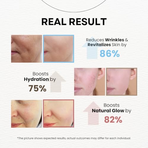 MPC Stem Cell Moisturizing Cream ? Anti-aging, Wrinkle Care, Skin Regeneration. Firming, Deep Hydration, Face Moisturizer with Caviar, Niacinamide and Peptides, Korean Skin Care 3.38 fl oz