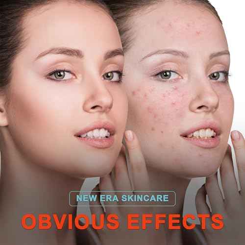 Elitzia Red Light Therapy Electronic Patch 6-Pack Reusable Hydrocolloid Patch Reduce Blemish Unclog Pores Skin Care for Sensitive Skin Home Use ETEAP6