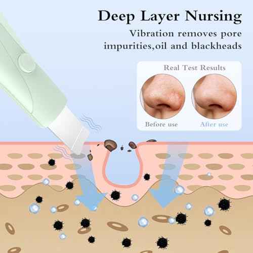 Skin Scrubber Face Spatula Skin Spatula Pore Cleaner Blackhead Remover Tools for Facial Deep Cleansing Skin Care Tool for Men and Women (Green)