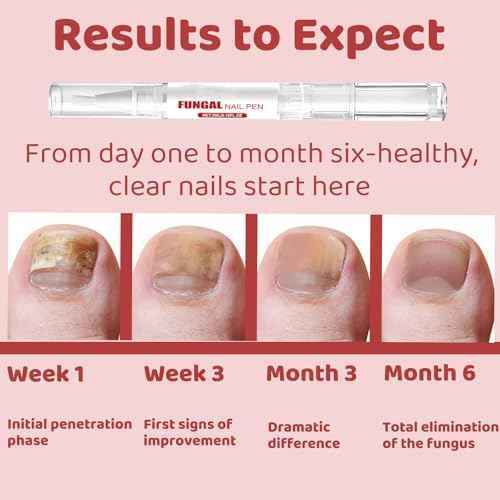 Fungal Nail Pen with Allicin & Undecylenic Acid, Extra Strength Nail Repair for Yellow, Discolored, Thick or Damaged Nails, Toenail & Fingernail Care (2PCS)