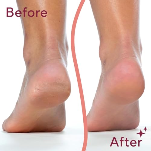 Electric Foot Callus Remover, Pedicure Grinder, Sander & Filer Tools for Effective Feet Scrubber (Removedor De Callos En Los Pies) (Pink-Grey)