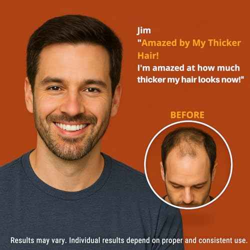 Minoxidil for Men 5% Topical Solution ? Beard & Hair Regrowth Treatment, Extra Strength Hair Loss Formula for Thicker, Fuller Hair, Hair Growth Serum for Men