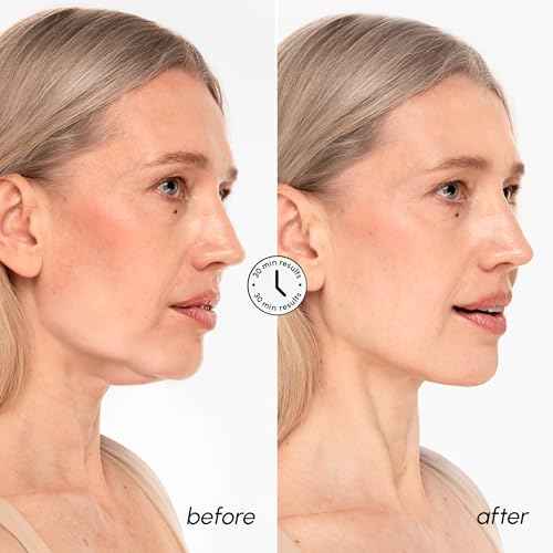 MAREE V Line Lifting Mask with 24K Gold ? Deep Collagen Face Mask for Women ? Jawline Shaper Mask with Retinol & Hyaluronic Acid ? Neck Tightening & Firming - Double Chin Strap for Face Lift
