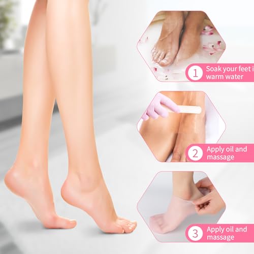 2 Pairs Silicone Moisturizing Socks for Dry Cracked Feet Women, Soft Gel Pedicure Foot Spa Aloe Socks, Anti-Slip Moisturizer Socks for Dry Cracked Feet Overnight Foot Care Pink&White