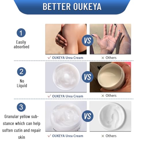 OUKEYA Urea Cream 40 Percent,Foot & Hand Cream for Dry Cracked,Urea Lotion for Feet Maximum Strength