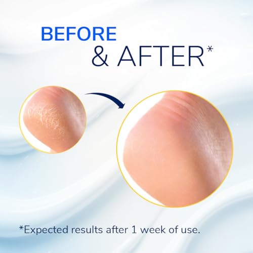 Dr. Scholl's Severe Cracked Heel Repair Restoring Balm 2.5oz, with 25% Urea for Dry, Cracked Feet, Heals and Moisturizes for Healthy Feet