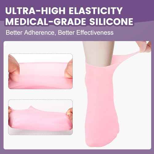 2 Pairs Silicone Socks for Dry Cracked Feet, Women's Foot Socks for Moisturizing (Pink & Beige, Fits Up to Size 9)
