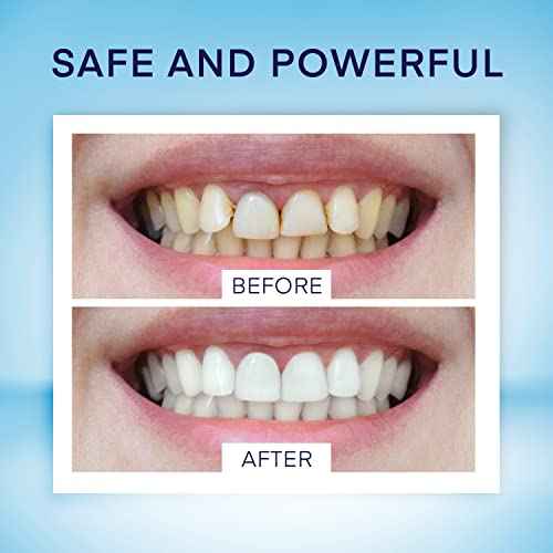 Teeth Whitening Pen (4 Pens) for Teeth Whitening, 40+ Uses, Effective, Painless, No Sensitivity, Travel-Friendly, Beautiful White Smile, Mint Flavor