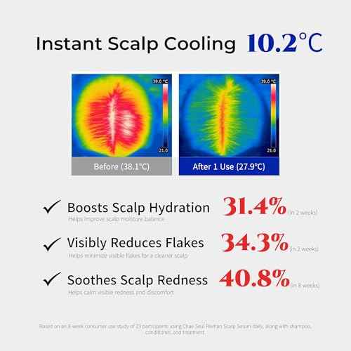 Revhan Scalp Serum for Hair Loss & Thinning ? Hair Growth Serum for Men & Women w/Salicylic Acid & Centella Asiatica ? Soothes Itchy, Irritated Scalp with Roll-On