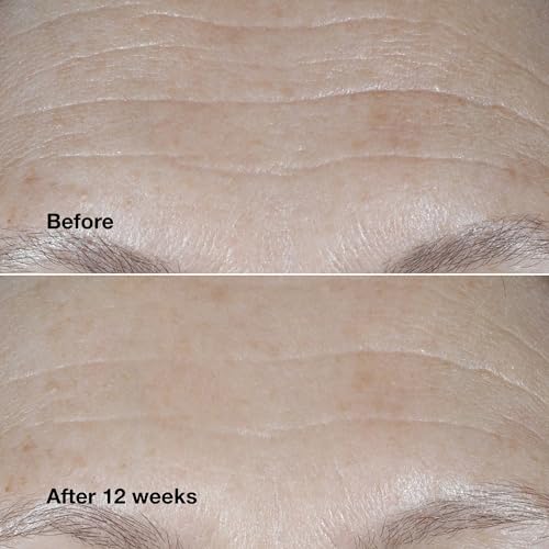 Clinique Smart Clinical Repair Broad Spectrum SPF 30 Wrinkle Correcting Cream with Peptides, Hyaluronic Acid + Glycerin | Protecting + Repairing