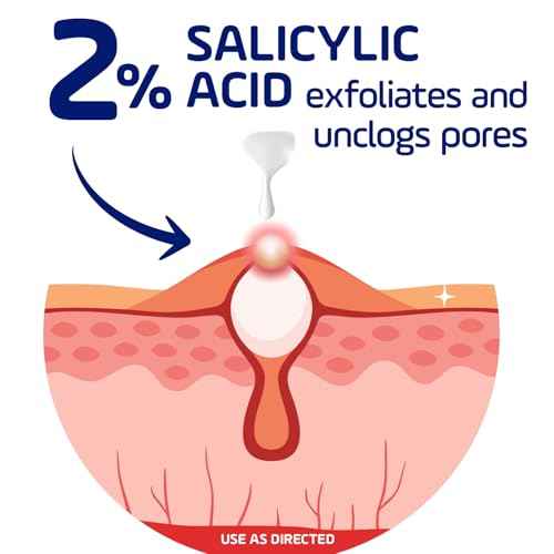 Asepxia 2% Salicylic Acid Acne Spot Treatment Cream | Drying Formula Targets Acne, Clears & Prevents Blemishes, Reduces Redness, Penetrates Pores, Pimple Cream, 1 Oz, 3-Pack