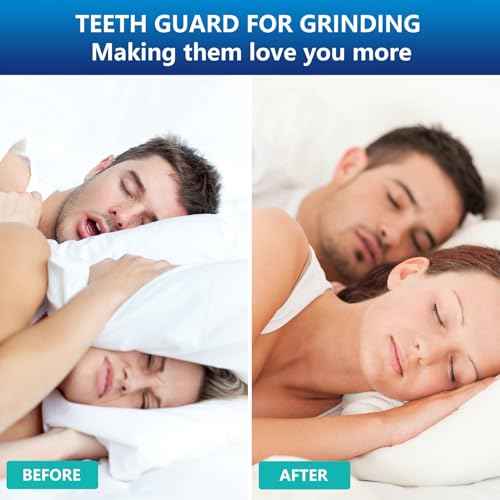 Mouth Night Guards for Teeth Grinding, Mouthguards for Grinding of Teeth, Mouth Guard for Clenching Teeth at Night with 12 Cleaning Tablets