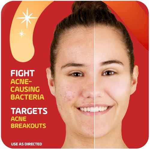 Asepxia 2% Salicylic Acid Acne Spot Treatment Cream | Drying Formula Targets Acne, Clears & Prevents Blemishes, Reduces Redness, Penetrates Pores, Pimple Cream, 1 Oz, 3-Pack