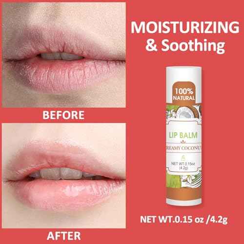 32 Pack Lip Balm, Natural Lip Balm Bulk with Vitamin E and Coconut Oil, Bulk Lip Balms for Dry Lips-16 Flavors