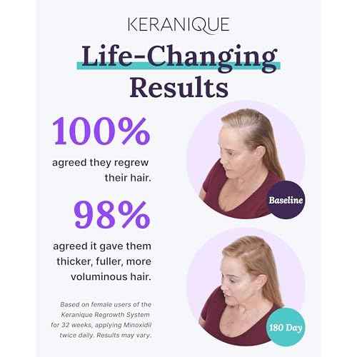 Keranique Hair Growth Products Set - 2% Minoxidil Keranique Hair Regrowth Treatment for Women - Deep Hydrating Shampoo and Conditioner - Hair Thickening & Volumizing Spray - Hair Loss Treatment System