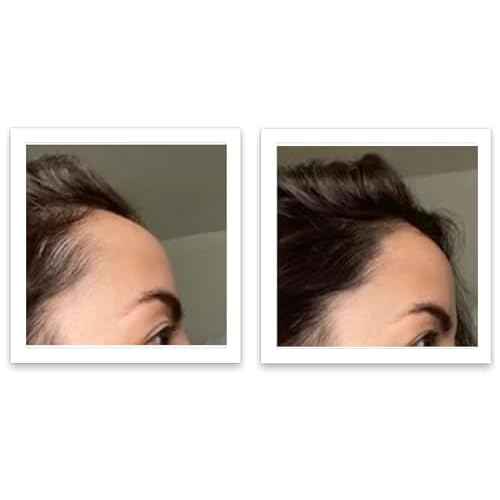 Caboki 10X Volumizing Hair Powder for Thinning Hair: Root Touch Up for Men and Women, Fill in Hairline & Edges, Cover Bald Spots. TALC-Free, Dark Gray